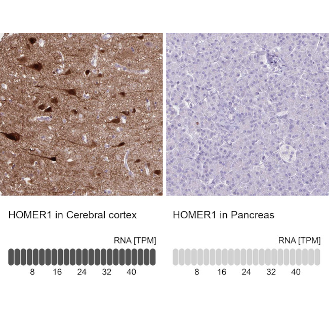 HOMER1 Antibody in Immunohistochemistry (IHC)