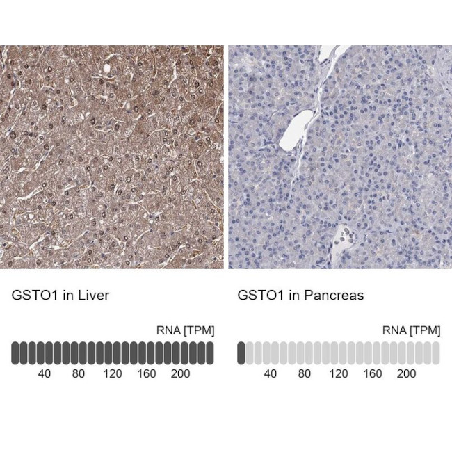 GST Omega 1 140A Antibody