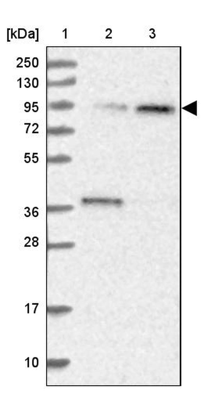 APC5 Antibody in Western Blot (WB)