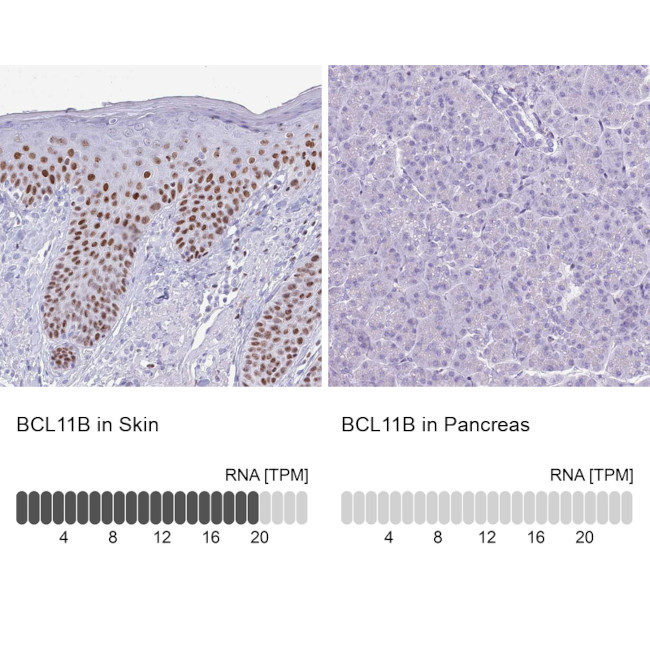 BCL11B Antibody in Immunohistochemistry (IHC)