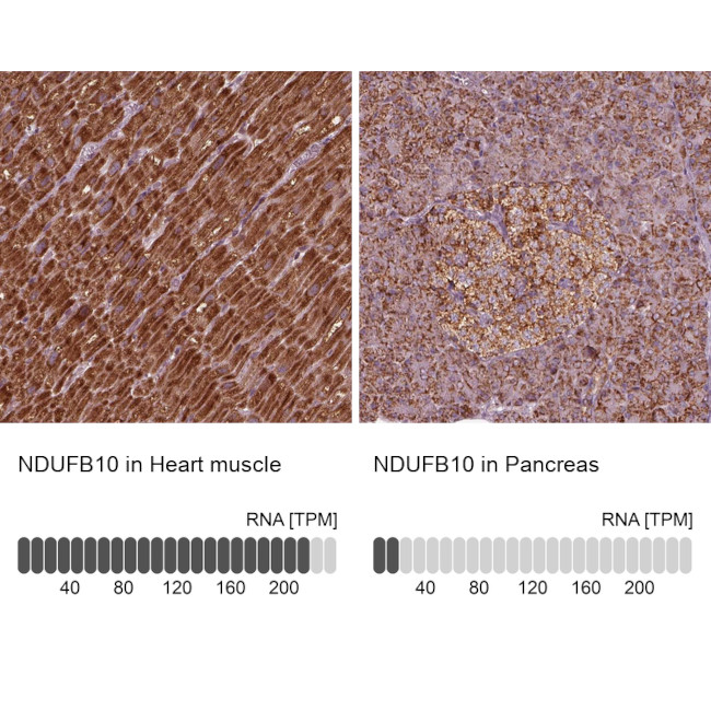 NDUFB10 Antibody in Immunohistochemistry (IHC)