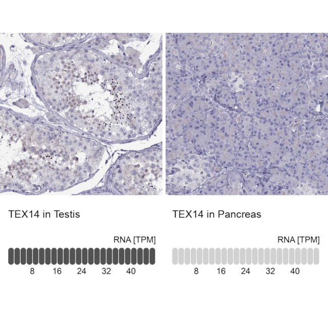 TEX14 Antibody in Immunohistochemistry (IHC)