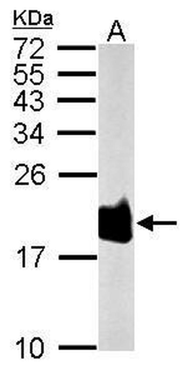 SOD1 Antibody in Western Blot (WB)