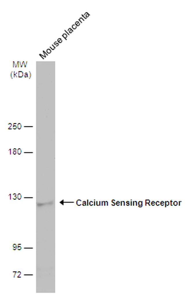Calcium Sensing Receptor Antibody in Western Blot (WB)