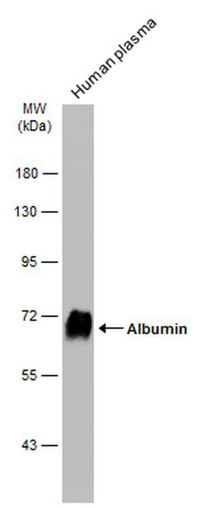Human Serum Albumin Antibody in Western Blot (WB)