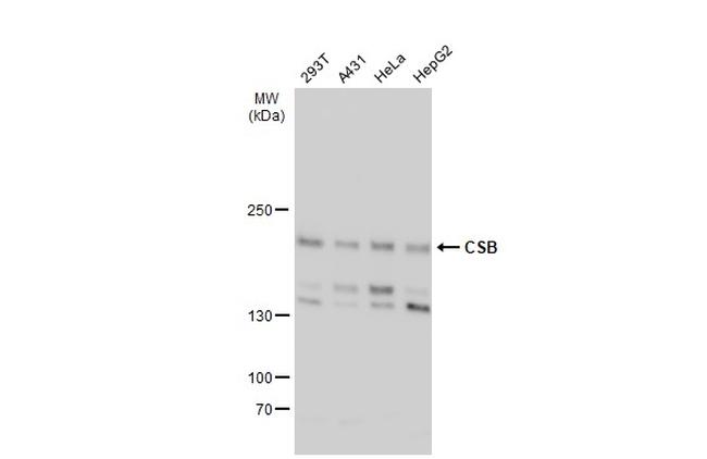 CSB Antibody in Western Blot (WB)