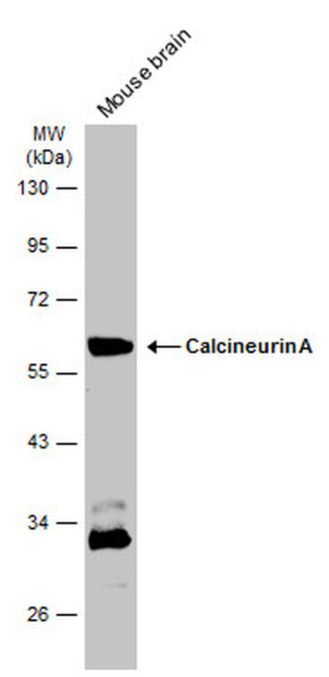 Calcineurin A Antibody in Western Blot (WB)