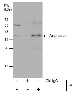 Arginase 1 Antibody in Immunoprecipitation (IP)