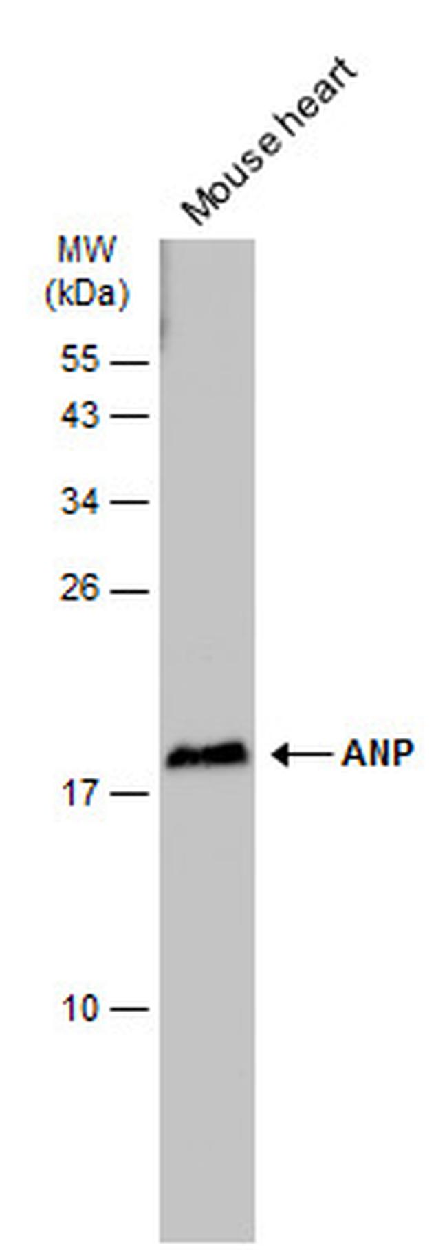 ANP Antibody in Western Blot (WB)