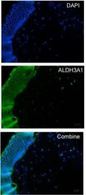ALDH3A1 Antibody in Immunohistochemistry (Frozen) (IHC (F))