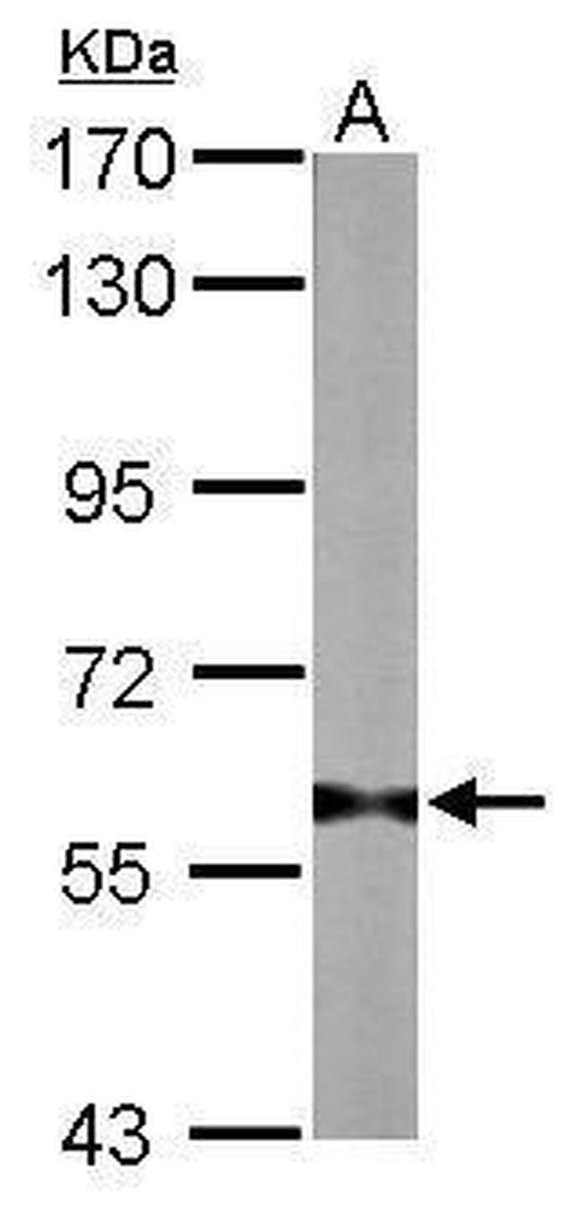 PRMT3 Antibody in Western Blot (WB)