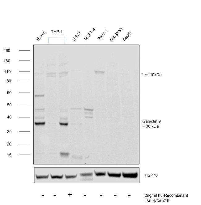 Galectin 9 Antibody in Western Blot (WB)