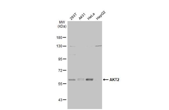 AKT2 Antibody in Western Blot (WB)