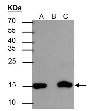 H3K27ac Antibody in Immunoprecipitation (IP)