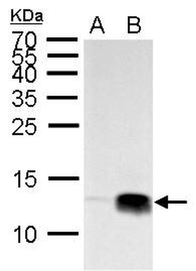 H4K20me3 Antibody in Western Blot (WB)
