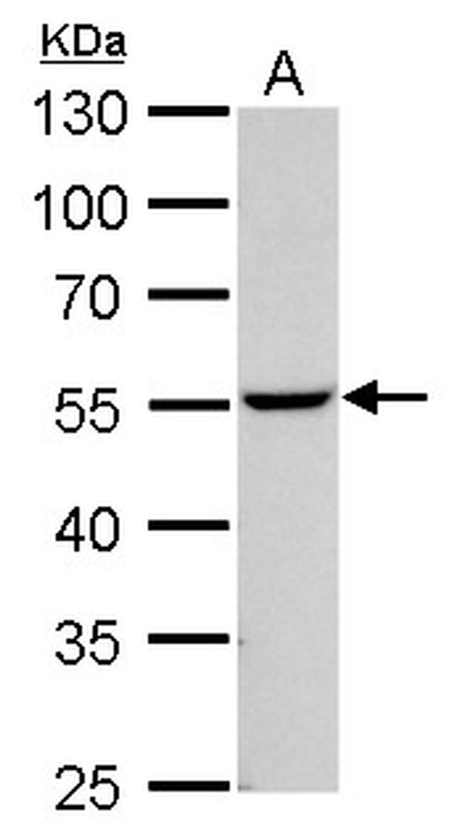 NAMPT Antibody in Western Blot (WB)