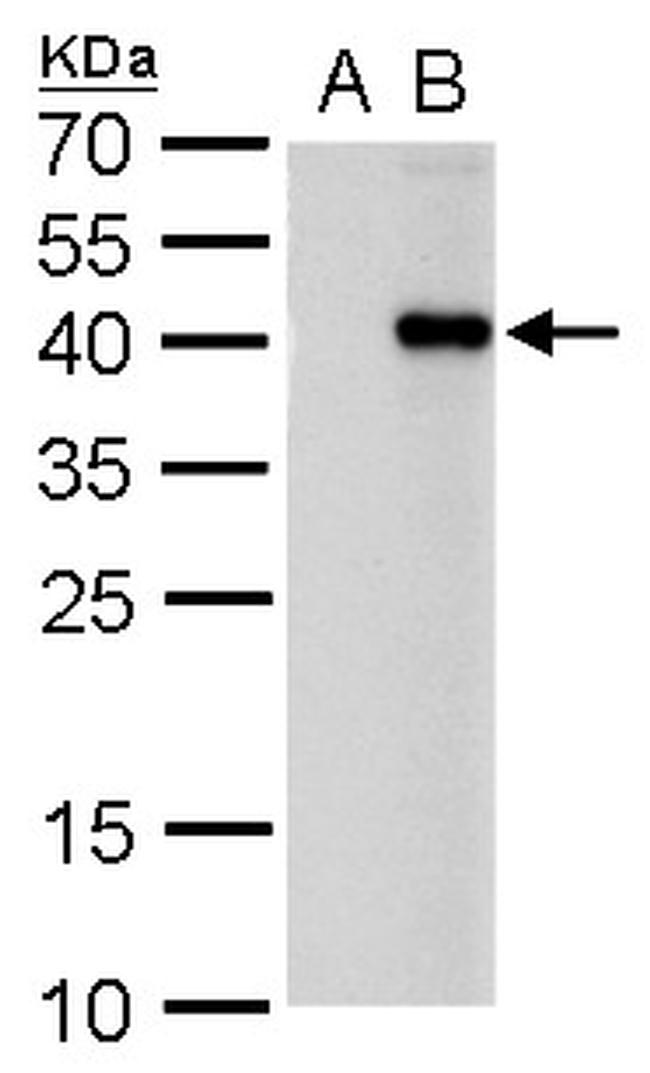 PITX2 Antibody in Western Blot (WB)