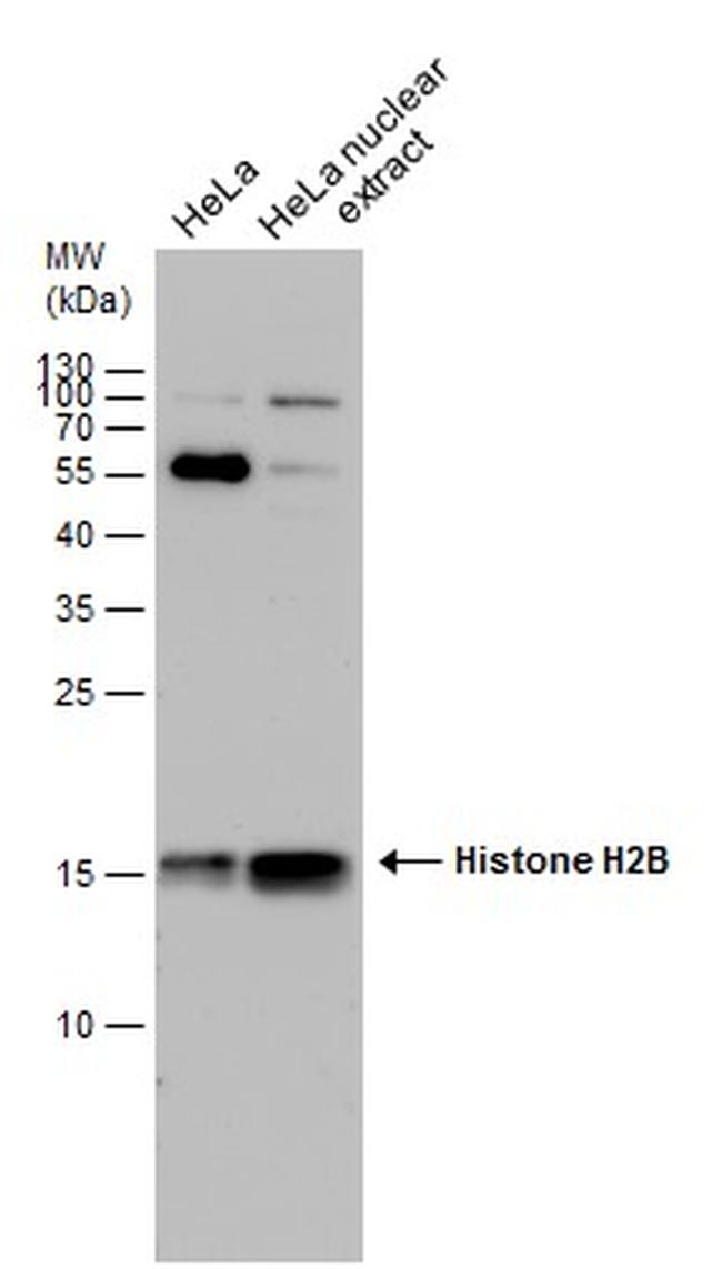 Histone H2B Antibody in Western Blot (WB)