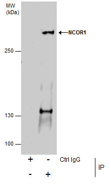 NCoR1 Antibody in Immunoprecipitation (IP)