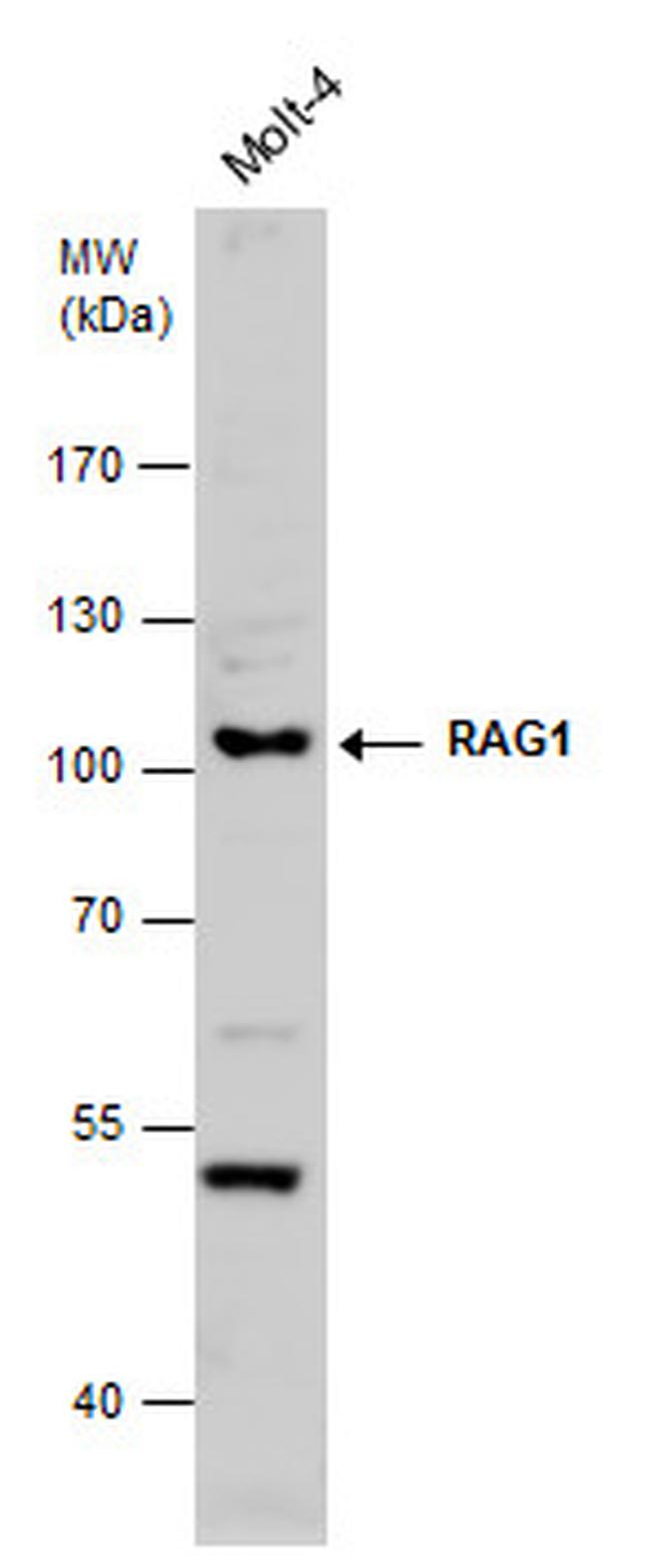 RAG1 Antibody in Western Blot (WB)