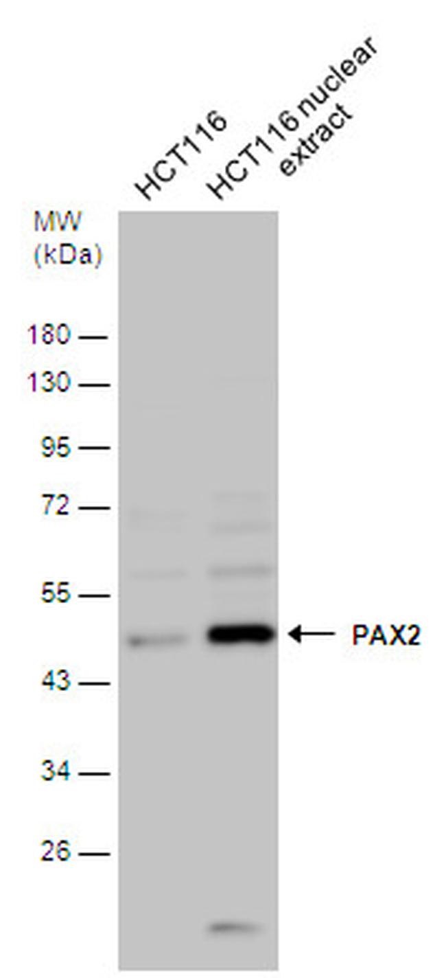 Phospho-PAX2 (Ser393) Antibody in Western Blot (WB)