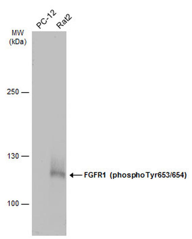 Phospho-FGFR1 (Tyr653, Tyr654) Antibody in Western Blot (WB)