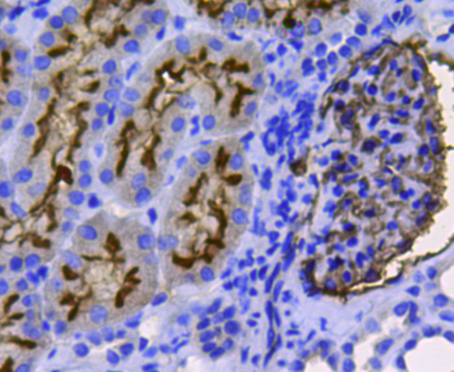 CD10 Antibody in Immunohistochemistry (Paraffin) (IHC (P))
