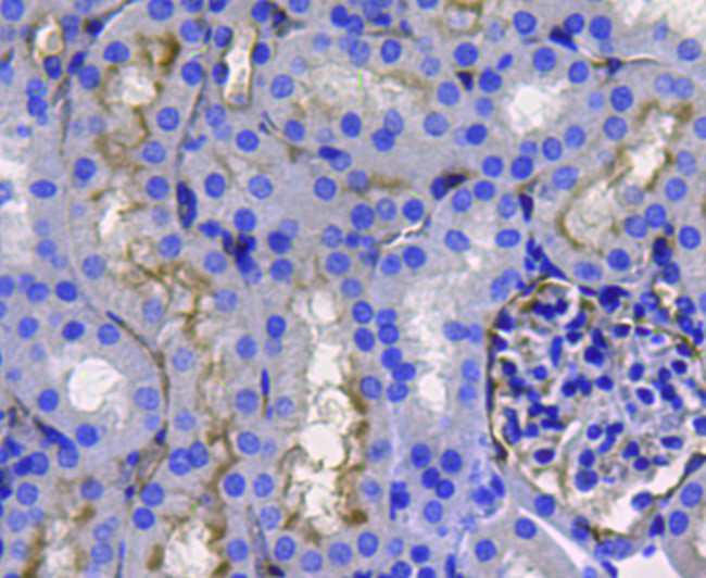 CD10 Antibody in Immunohistochemistry (Paraffin) (IHC (P))