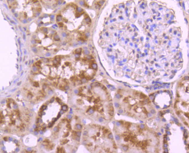 CD171 (L1CAM) Antibody in Immunohistochemistry (Paraffin) (IHC (P))