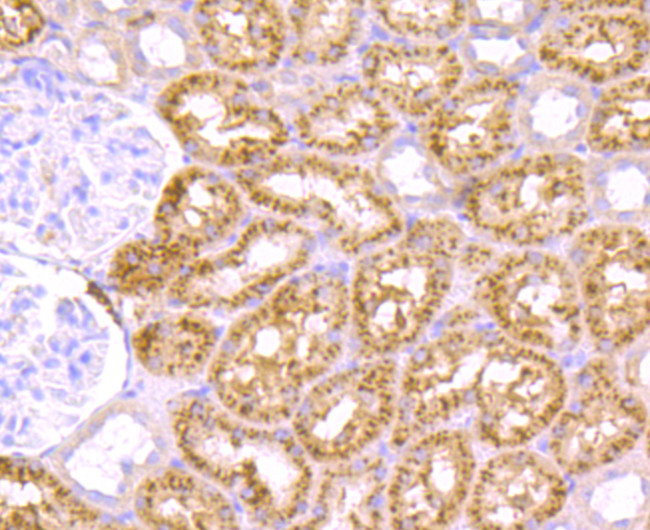 CD61 (Integrin beta 3) Antibody in Immunohistochemistry (Paraffin) (IHC (P))