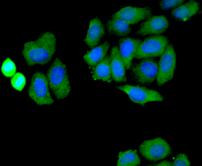 NOX4 Antibody in Immunocytochemistry (ICC/IF)
