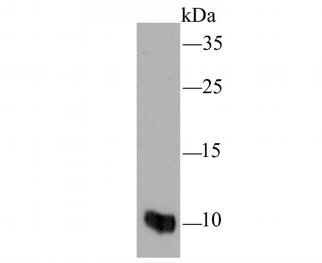 S100A8 Antibody in Western Blot (WB)