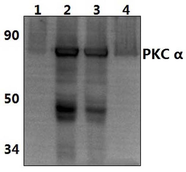 PKC alpha Antibody in Western Blot (WB)