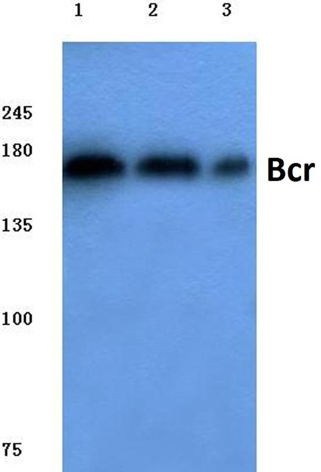 BCR Antibody in Western Blot (WB)