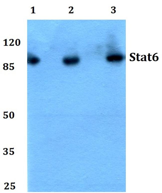 STAT6 Antibody in Western Blot (WB)