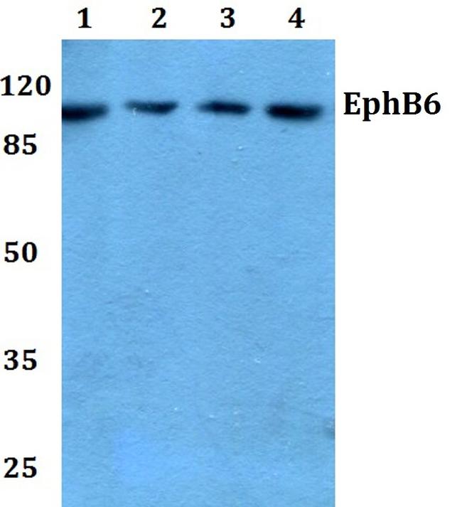 EphB6 Antibody in Western Blot (WB)