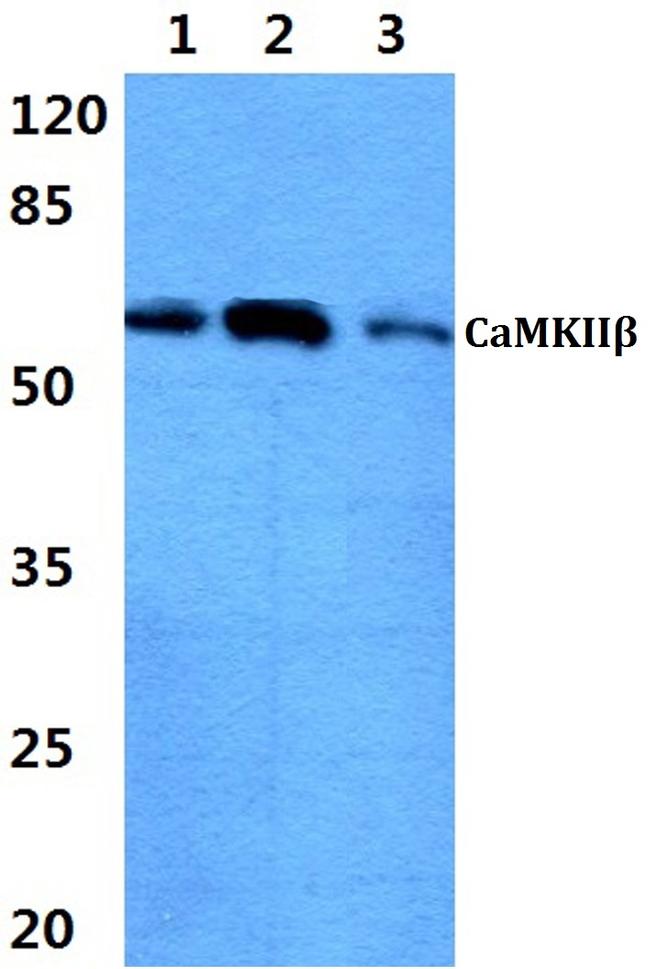 CaMKII beta Antibody in Western Blot (WB)