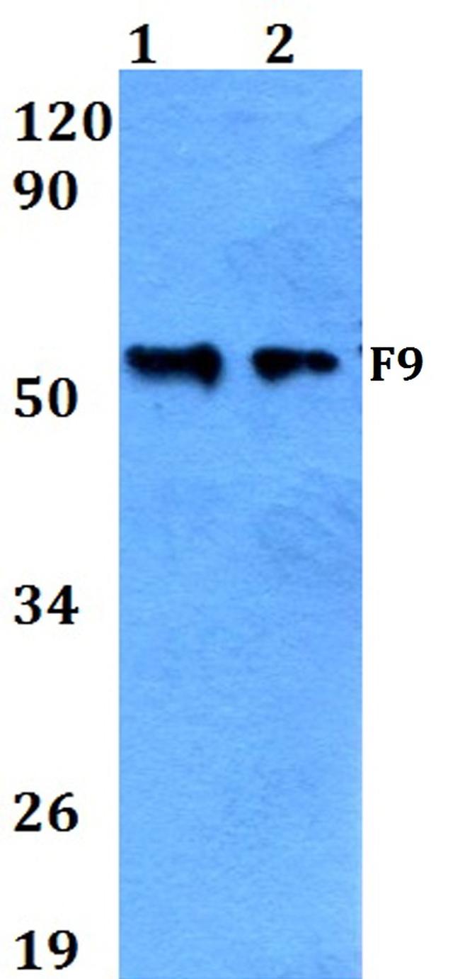 Factor IX Antibody in Western Blot (WB)