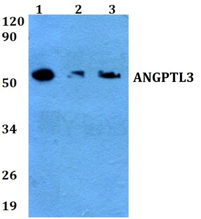 ANGPTL3 Antibody in Western Blot (WB)