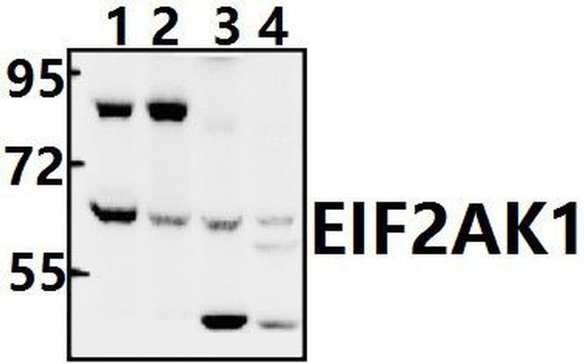eIF2 beta Antibody in Western Blot (WB)