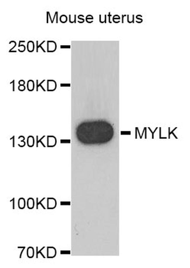 MYLK Antibody in Western Blot (WB)
