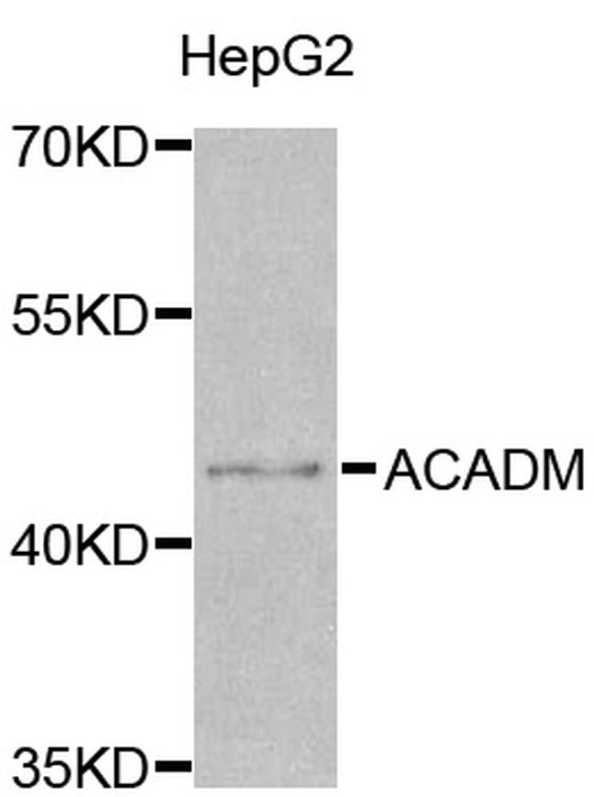 ACADM Antibody in Western Blot (WB)