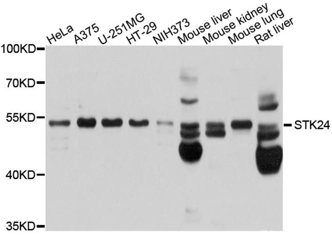 MST3 Antibody in Western Blot (WB)