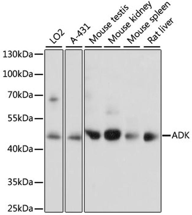 Adenosine Kinase Antibody in Western Blot (WB)