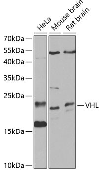 VHL Antibody in Western Blot (WB)