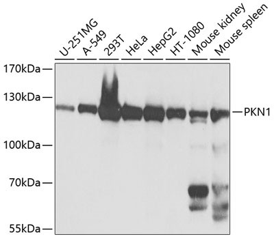 PKN1 Antibody in Western Blot (WB)