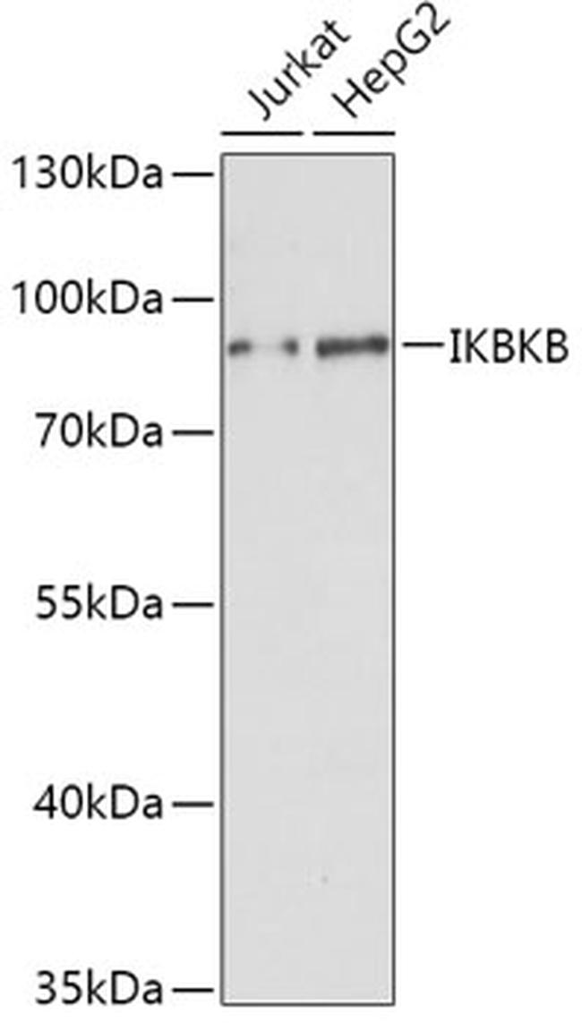 IKK beta Antibody in Western Blot (WB)