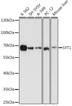 Synaptotagmin 1 Antibody in Western Blot (WB)