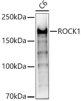 ROCK1 Antibody in Western Blot (WB)