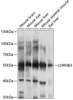 CHRNB3 Antibody in Western Blot (WB)